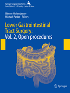 Lower Gastrointestinal Tract Surgery: Vol. 2, Open procedures