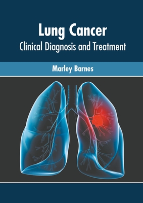 Lung Cancer: Clinical Diagnosis and Treatment - Barnes, Marley (Editor)