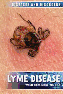 Lyme Disease: When Ticks Make You Sick