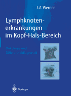 Lymphknotenerkrankungen Im Kopf-Hals-Bereich: Onkologie Und Differenzialdiagnostik