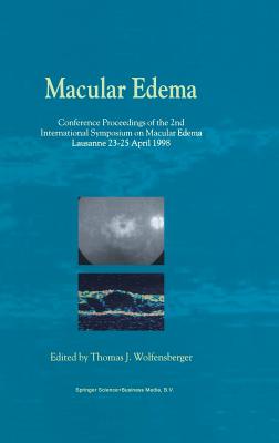 Macular Edema: Conference Proceedings of the 2nd International Symposium on Macular Edema, Lausanne, 23-25 April 1998 - Wolfensberger, Thomas J (Editor)
