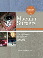 Macular Surgery