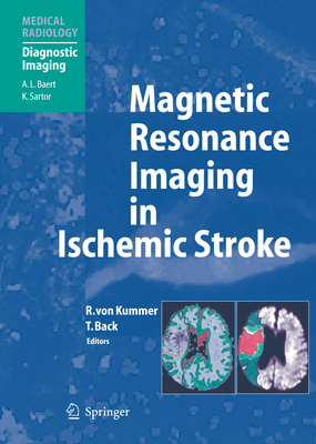 Magnetic Resonance Imaging in Ischemic Stroke - Von Kummer, Rdiger (Editor), and Sartor, K (Foreword by), and Back, Tobias (Editor)