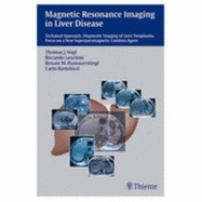 Magnetic Resonance Imaging in Liver Disease: Technical Approach, Diagnostic Imaging of Liver Neoplasms, Focus on a New Superparamagnetic Contrast Agent