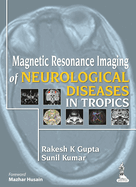 Magnetic Resonance Imaging of Neurological Diseases in Tropics