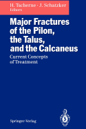 Major Fractures of the Pilon, the Talus, and the Calcaneus: Current Concepts of Treatment