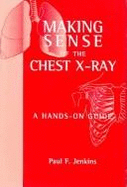 Making Sense of the Chest X-Ray: A Hands-On Guide - Hodder Arnold Publishing (Creator)