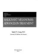 Malignant Melanomas: Advances in Treatment - Leong, Stanley P L