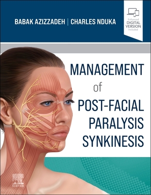 Management of Post-Facial Paralysis Synkinesis - Azizzadeh, Babak, M.D. (Editor), and Nduka, Charles (Editor)