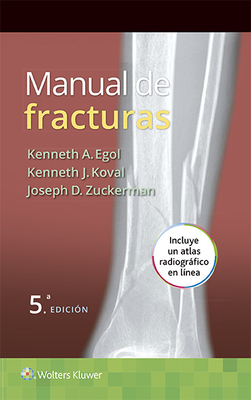 Manual de Fracturas - Egol, Kenneth, MD