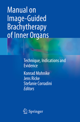 Manual on Image-Guided Brachytherapy of Inner Organs: Technique, Indications and Evidence - Mohnike, Konrad (Editor), and Ricke, Jens (Editor), and Corradini, Stefanie (Editor)