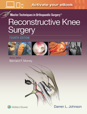 Master Techniques in Orthopaedic Surgery: Reconstructive Knee Surgery - Johnson, Darren L, MD