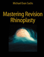 Mastering Revision Rhinoplasty