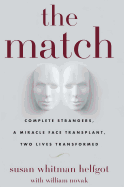 Match: Complete Strangers, a Miracle Face Transplant, Two Lives Transformed