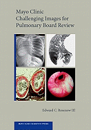 Mayo Clinic Challenging Images for Pulmonary Board Review (Mayo Clinic Scientific Press)