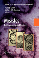 Measles: History and Basic Biology