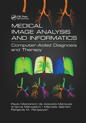 Medical Image Analysis and Informatics: Computer-Aided Diagnosis and Therapy - de Azevedo-Marques, Paulo Mazzoncini (Editor), and Mencattini, Arianna (Editor), and Salmeri, Marcello (Editor)