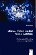 Medical Image Guided Thermal Ablation - Breen, Michael, Professor
