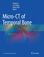 Micro-CT of Temporal Bone