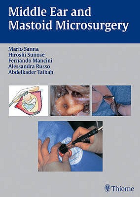 Middle Ear and Mastoid Microsurgery - Sanna, Mario, and Sunose, Hiroshi, and Mancini, Fernando