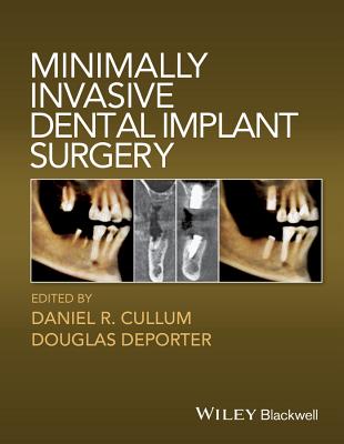 Minimally Invasive Dental Implant Surgery - Cullum, Daniel R. (Editor), and Deporter, Douglas (Editor)