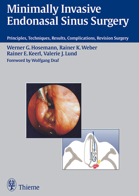 Minimally Invasive Endonasal Sinus Surgery: Principles, Techniques, Results, Complications, Revision Surgery - Hosemann, Werner G., and Lund, Valerie J., and Weber, Rainer K.