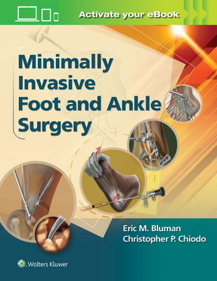 Minimally Invasive Foot & Ankle Surgery - Bluman, Eric M, Dr., PhD, and Chiodo, Christopher