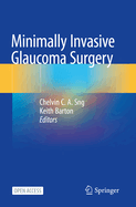 Minimally Invasive Glaucoma Surgery