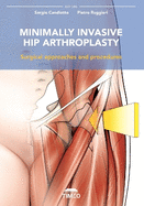 Minimally Invasive Hip Arthroplasty: Surgical Approaches and Procedures