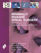 Minimally Invasive Spinal Surgery: Principles and Evidence-Based Practice
