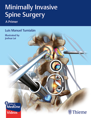 Minimally Invasive Spine Surgery: A Primer - Tumialan, Luis Manuel