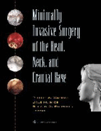Minimally Invasive Surgery of the Head, Neck, and Cranial Base
