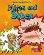 Mites and Bites - Royston, Angela