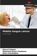 Mobile tongue cancer
