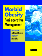 Morbid Obesity: Peri-Operative Management