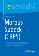 Morbus Sudeck (CRPS): Fortschritte in Pathogenese, Diagnose und Therapie
