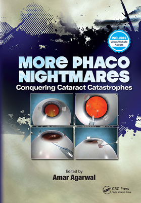 More Phaco Nightmares: Conquering Cataract Catastrophes - Agarwal, Amar