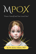 Mpox: Protect Yourself and Your Loved Ones