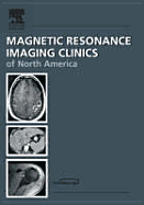 Mr-Guided Interventions, an Issue of Magnetic Resonance Imaging Clinics: Volume 13-3 - Lewin, Jonathan, MD