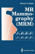 MR Mammography (Mrm)