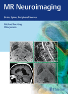 MR Neuroimaging: Brain, Spine, Peripheral Nerves