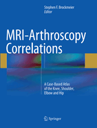 MRI-Arthroscopy Correlations: A Case-Based Atlas of the Knee, Shoulder, Elbow and Hip