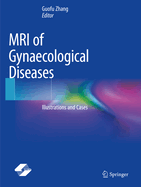 MRI of Gynaecological Diseases: Illustrations and Cases