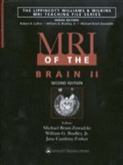 MRI of the Brain 2