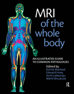 MRI of the Whole Body: An Illustrated Guide for Common Pathologies