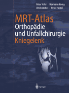 MRT-Atlas Orthopadie Und Unfallchirurgie: Kniegelenk