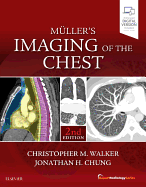Muller's Imaging of the Chest: Expert Radiology Series