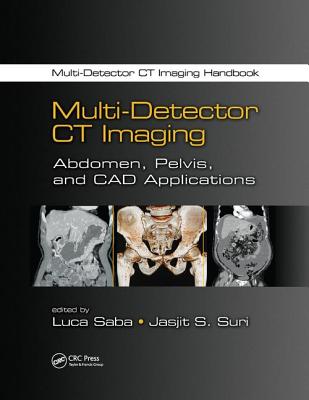Multi-Detector CT Imaging: Abdomen, Pelvis, and CAD Applications - Saba, Luca (Editor), and Suri, Jasjit S. (Editor)