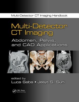 Multi-Detector CT Imaging: Abdomen, Pelvis, and CAD Applications - Saba, Luca (Editor), and Suri, Jasjit S. (Editor)