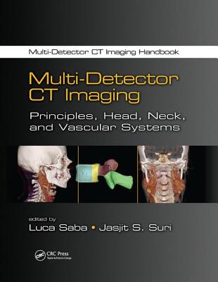 Multi-Detector CT Imaging: Principles, Head, Neck, and Vascular Systems - Saba, Luca (Editor), and Suri, Jasjit S. (Editor)